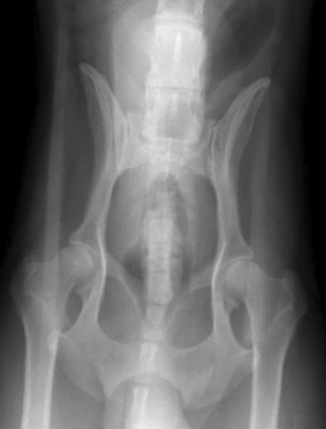 正常股関節のレントゲン写真