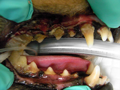 歯石または歯周病の写真